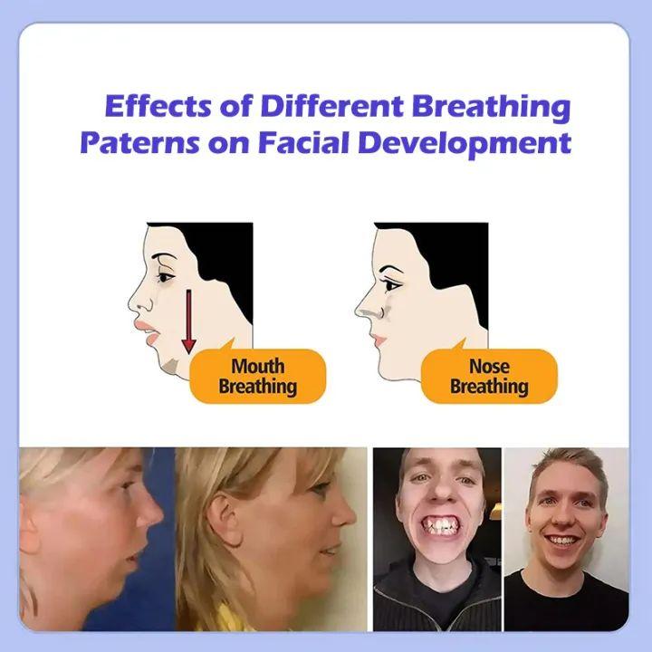 Băng Dính Đóng Miệng Chống Ngáy, 30 Cái / hộp, Hỗ Trợ Giấc Ngủ, Giúp Thở, Dán Miệng, Chất Liệu Vải Không Dệt, Dán Tắt, Thích Hợp Cho Người Lớn Và Trẻ Em, Dán Ngủ Dễ Dàng 3