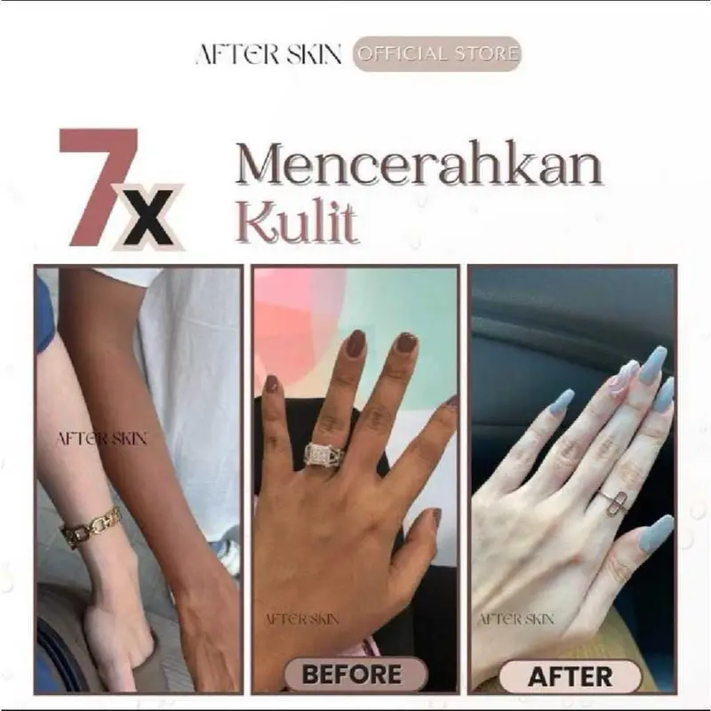 [ BELI 5 PCS LEBIH HEMAT ]Gratis Ongkir Sabun Pemutih After Skin Alpha Arbutin Collagen - Dapatkan 5pcs - Pewangi, Soap Mandi Mencerahkan 6