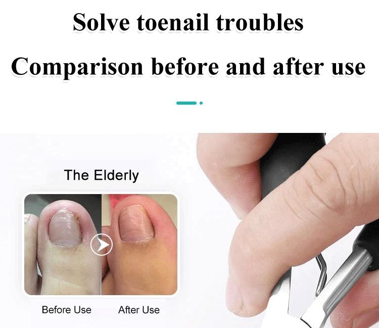 Product Introduction of Nail clippers for ingrown toenails single hawkbill clippers for gray fingernails nail fissures 9