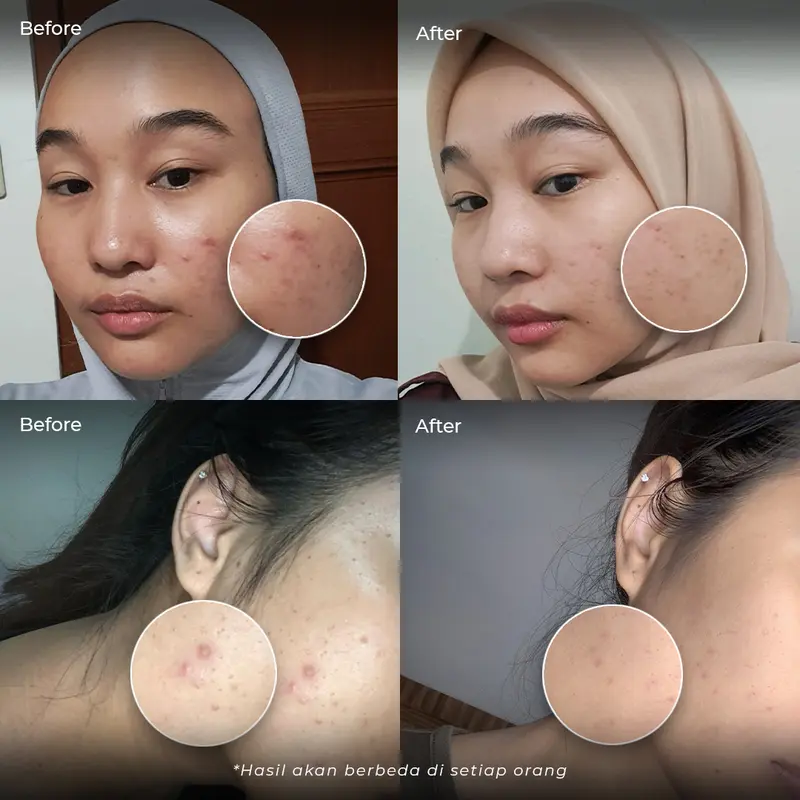elastigen - Minuman Kolagen dengan Verisol & Glutathione OPITAC isi 10 Sachet 3
