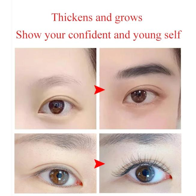 Herbal Hair Growth Tonic/Jus Penumbuh Rambut Usma Serum Herbal Penumbuh Rambut Bulu Mata Alis Rambut Serum Penumbuh Rambut Anti Kebotakan Menebalkan Rambut Mempercepat Pertumbuhan Rambut Herbal Hair Growth Tonic/Jus Penumbuh Rambut Usma Serum Herbal Penumbuh Rambut Bulu Mata Alis Rambut Serum Penumbuh Rambut Anti Kebotakan Menebalkan Rambut Mempercepat Pertumbuhan Rambut