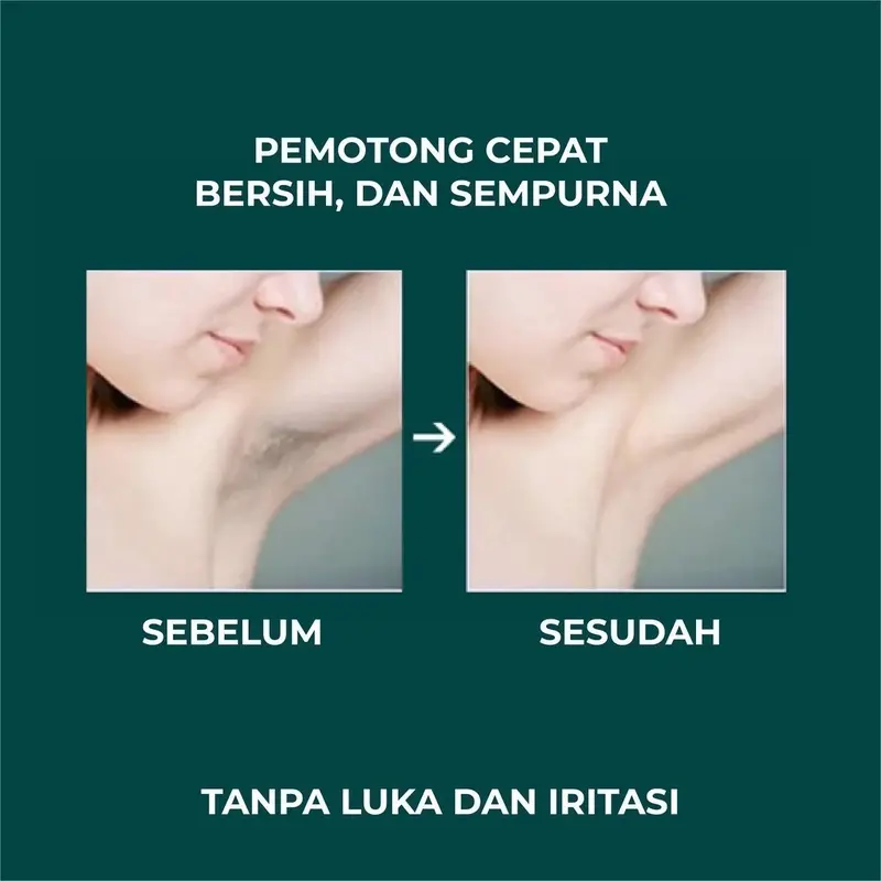 MISSAI Alat Mencukur Mini Listrik Pencukur Bulu Ketiak Wanita / Mini Lady Shaver / Tanpa Rasa Sakit Pencukur Rambut / Alat Pencukur Bulu Kemaluan Epilator BD03 4