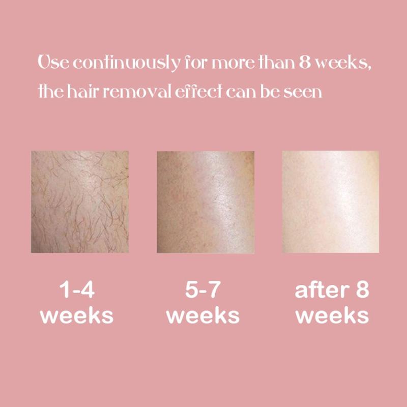 Paopao IPL LASER HAIR REMOVAL TANPA SAKIT EPILATOR / IPL ALAT PENGHILANG BULU PERMANEN IPL Hair Removal Tanpa Rasa Sakit 2