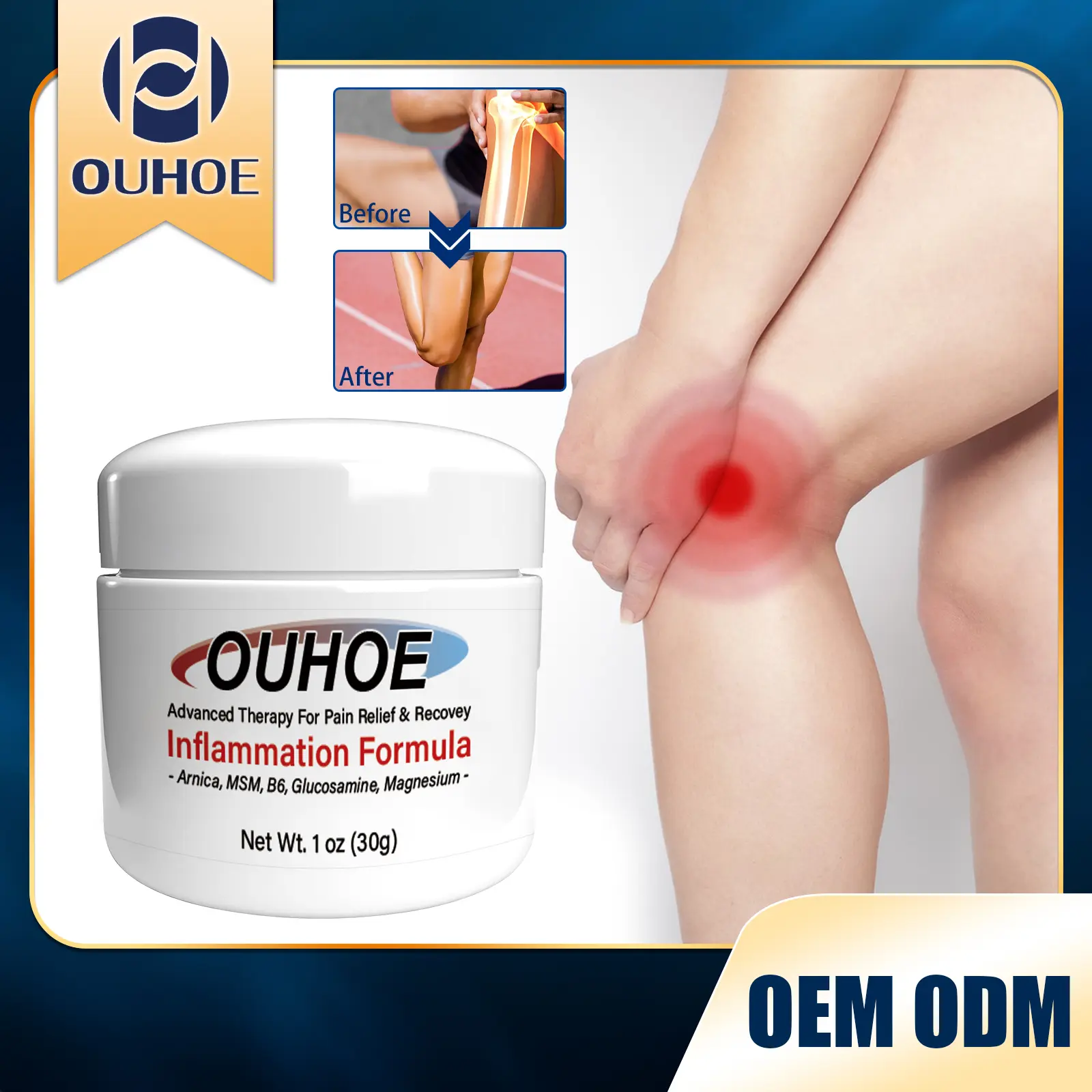 OUHOE Gel Sendi Glukosamin Joint Bone Therapy Krim Pengobatan Asam Sendi Pereda Nyeri Lutut 30g