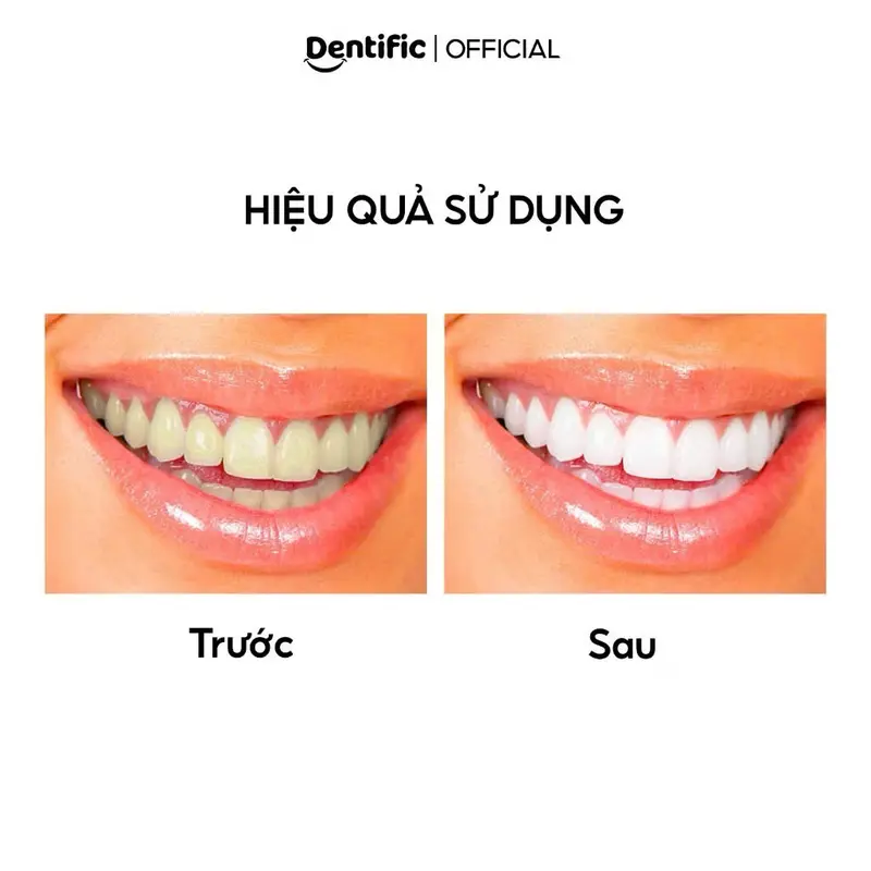 Kem đánh răng làm sạch răng Bright Me Smile Charcoal toothpaste Dentific 100g kem  đánh  răng 4