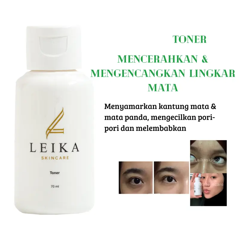 TONER Penghilang Mata Panda Penghilang Kantung Mata Kerutan Mata Mencerahkan Area Sekitar Mata Obat Mata Panda Toner Kelupas Mencerahkan 0