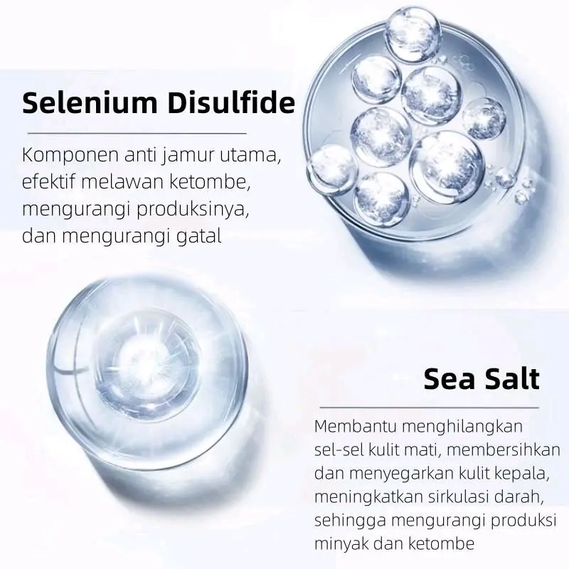 ( HEMAT ISI 2 BOTOL ) NIPPORI Selenium  Disulfide Haircare Shampoo Helps control oil and reduce dandruff Membantu mengontrol minyak dan mengurangi ketombe Gatal Perawatan Sampo 300ML 4