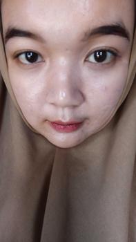 Product Review of DOSIS 2 ACNE - Paket Acne Ectoin+ Extra [for your Acne Treatment] from F**l N**a 1