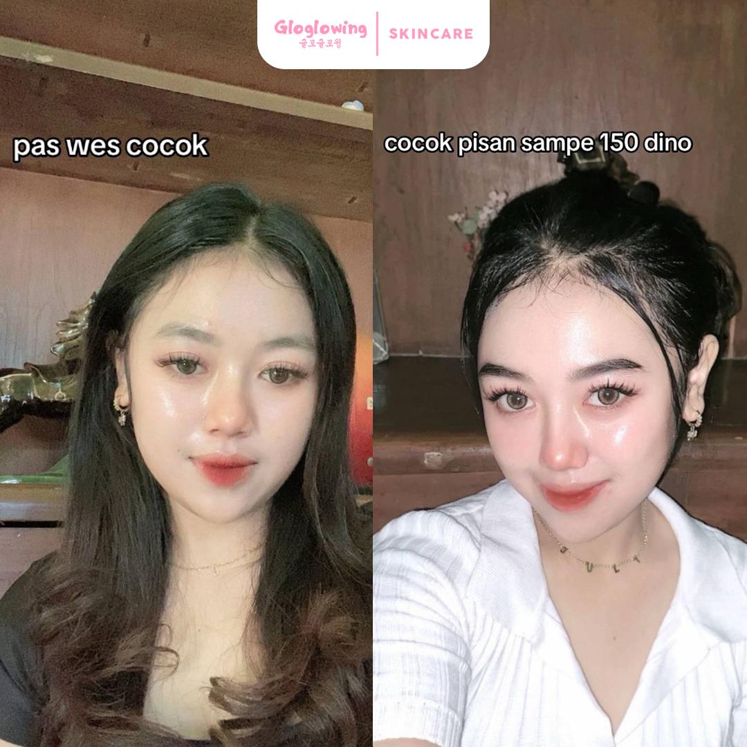 [HLIVE] DOSIS 1 - Paket Kinclong Booster White Truffle