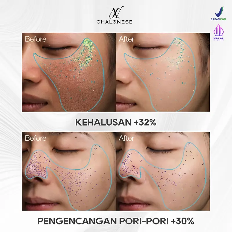CHALONESE Memutihkan Anti Kerut BPOM mengandung bosein 10% Niacinamide Brightening Moisturizer Glowing Moisture Gel 50g Cream Pemutih Wajah penuaan menghilangkan kerutan  Day Cream Night Cream 1