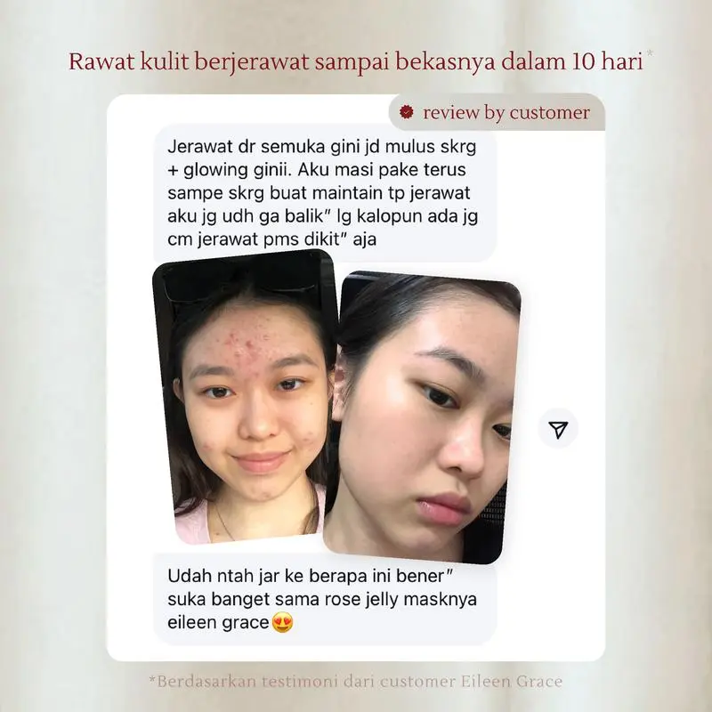 [SPECIAL LIVE] EILEEN GRACE - Moisturize Rose Jelly Mask 300 ml | Masker / skincare jerawat I Kulit kering sensitif | Bekas jerawat | Kemerahan | Bruntusan | Bopeng 4