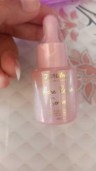 Product Review of Jglow Skincare Acne Refine Serum Refiing Untuk kulit Berjerawat dan Kulit kusam 20 ML from D**h 0