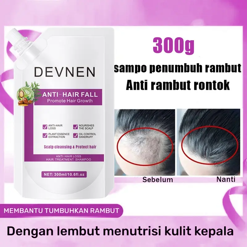 DEVNEN sampo anti rambut rontok 300ML Hair Growth Shampoo shampo penumbuh rambut cepat Anti rambut rontok Botak ginger shampoo kontrol minyak menyegarkan pelembab nutrisi Conditioner Haircare Ketombe Lebat 5