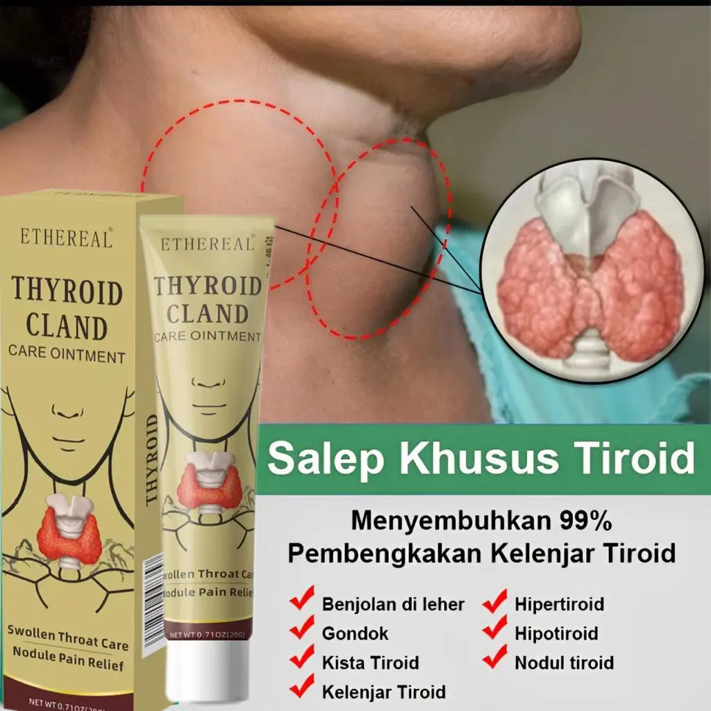 Krim Tiroid 20g Khusus Obat Gondok Kelenjar Tiroid Hipertiroid Leher Bengkak Mengurangi pembengkakan hipertiroid Perawatan kulit Wajah Muka Facial Aging Kering Hitam