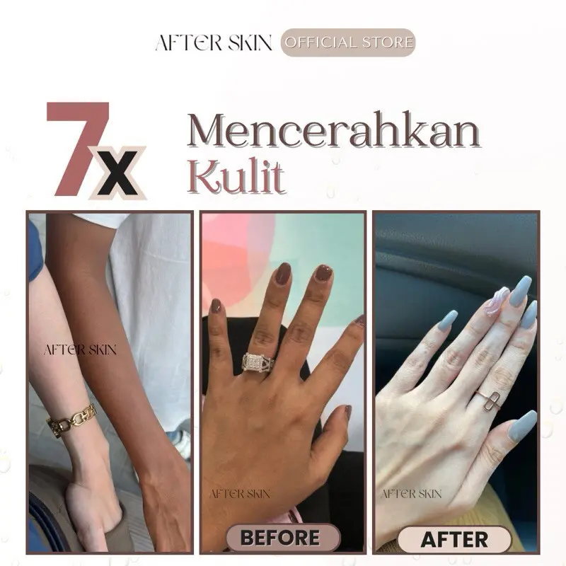 [ BELI 5 PCS LEBIH HEMAT ]Gratis Ongkir Sabun Pemutih After Skin Alpha Arbutin Collagen - Dapatkan 5pcs - Pewangi, Soap Mandi Mencerahkan 8