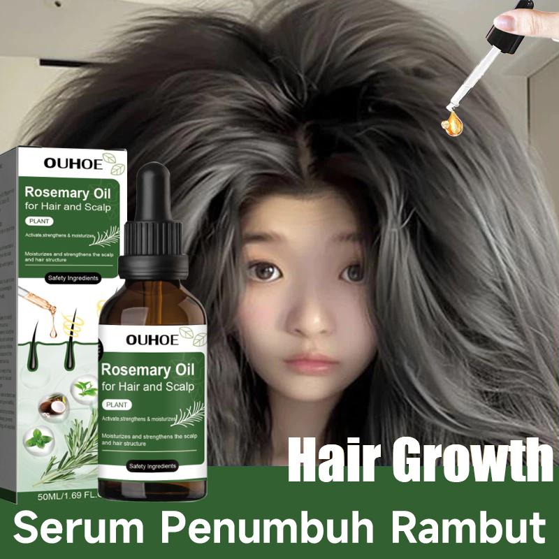 Rosemary hair oil hair tonic penumbuh rambut dengan cepat dan botak tebal serum rambut rontok Hair growth serum Minyak 1