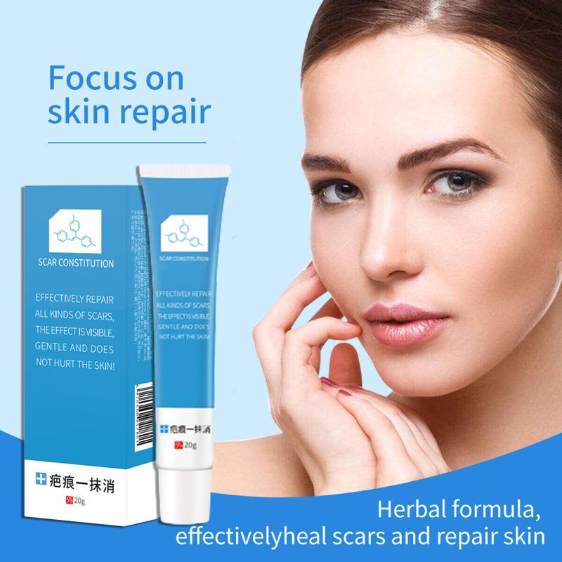 Product Introduction of Kem Loại Bỏ Sẹo, Để Phục Hồi Sẹo Thâm, Loại Bỏ Sẹo Rỗ, Loại Bỏ Vết Co Giãn 27
