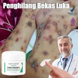 Penghilang bekas luka hitam koreng Penghilang bekas luka di kaki Penghilang Bekas cacar Bekas gigitan nyamuk Bekas lama Keloid