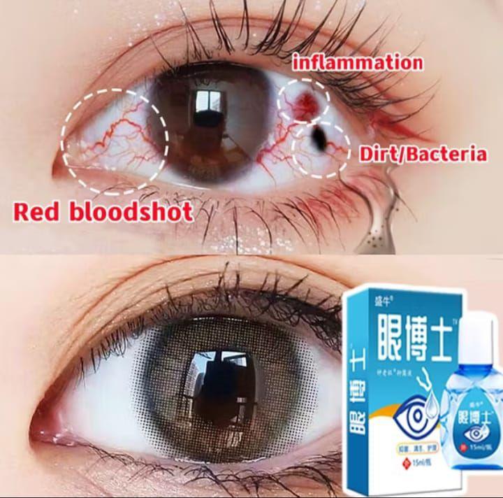 YEHUANGSU OBAT TETES MATA NO 1 JEPANG / TETES MATA JEPANG OBAT TETES MATA BERLEMAK KEKUNINGAN PTERIGIUM GLUKOMA MATA KATARAK