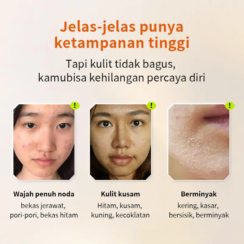 (Korea BPOM-COD) Anystar Skin Fit Tone up cream 30ml|Primer cream Invisible pore |Whitening and Mositurizing |Waterproof Foundation |Makeup Base All Day |Natural skin tone 4