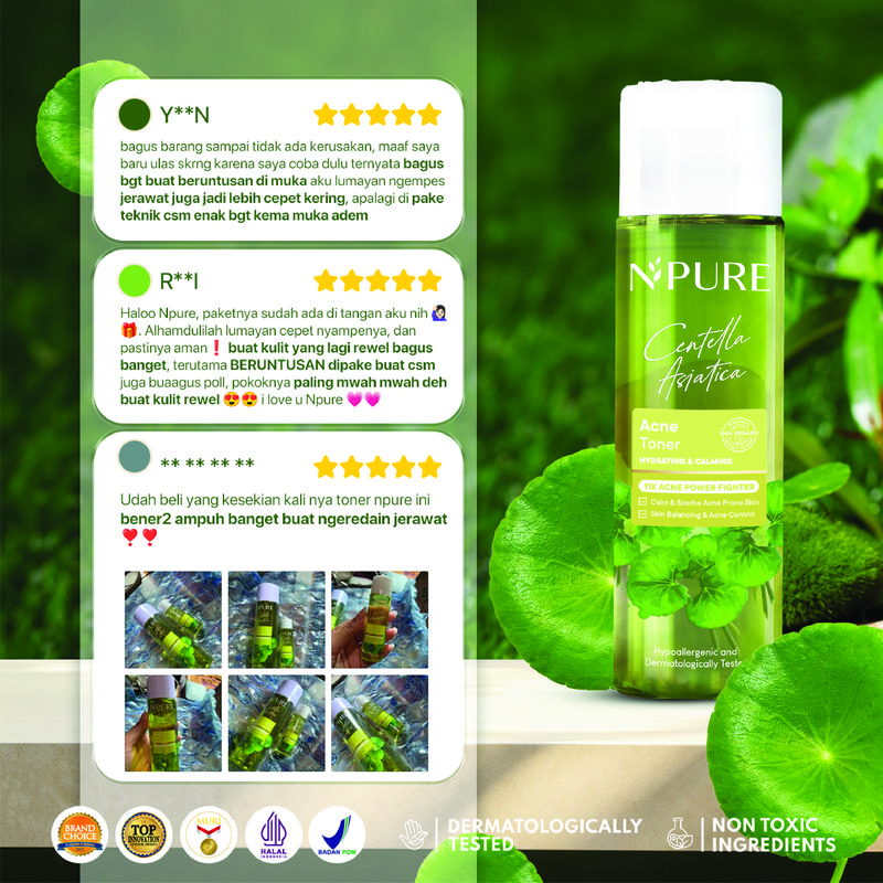 【Exclusive Ygrianii】Twinpack Toner NPURE Acne Face Toner Centella Asiatica 150 ml / Toner Kulit Berjerawat / Hydrating Toner Mencerahkan Wajah  Beruntusan Komedo Kotoran 3