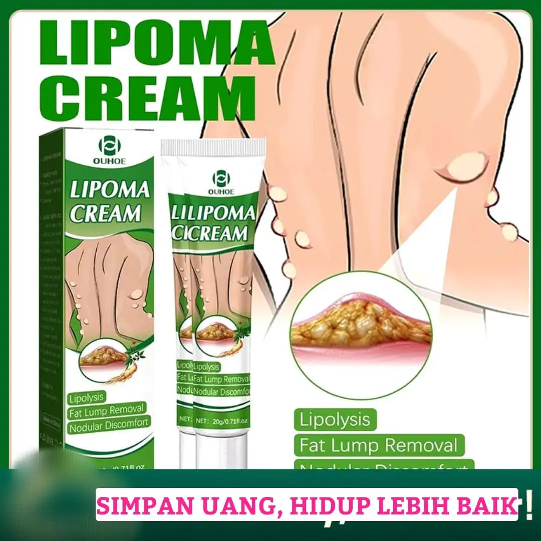 【Charbi ke ganthen hatayen】  Salep Krim OUHE Terlaris 20g Obat Lipoma Penghapus Benjolan Subkutan Pembengkakan Lemak Kelenjar Tiroid di Tubuh Penetrasi Dalam Menenangkan Ketidaknyamanan, Ucapkan Selamat Tinggal pada Benjolan Keras Subkutan