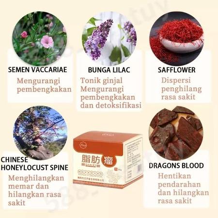 Lipoma Removal Cream Penghilang Kista & Lipoma Atasi Benjolan Lipoma Cepat Kempes Hilangkan Kista Lemak Kempes Tanpa Bedah