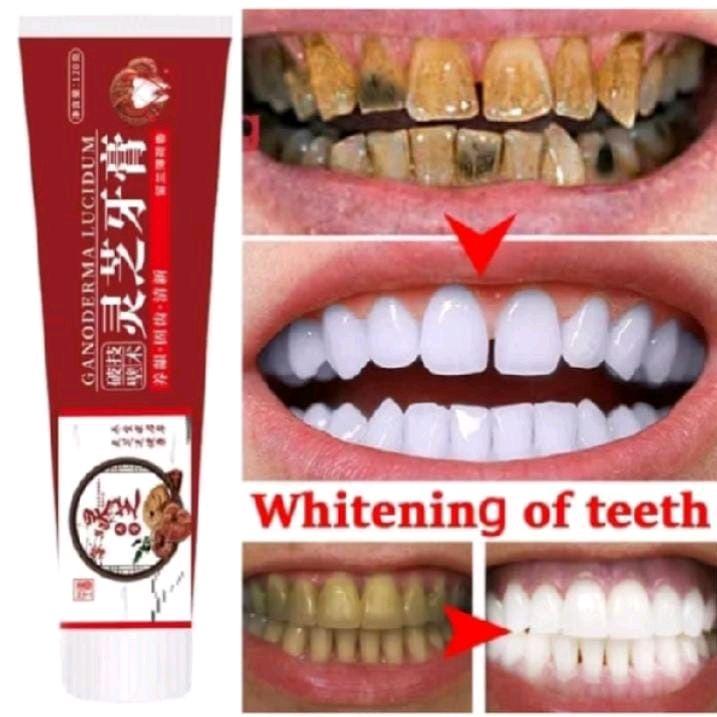 Lingzhi Toothpaste Pasta Gigi Pemutih Memutihkan Gigi Kuning Penghilang Karang Gigi Dan Pemutih Gigi Permanen 120g Odol Pembersih Karang Gigi Perawatan Pemutihan Gigi / Menghilangkan Bau Mulut/Perontok Karang Gigi/ Noda Asap / Menghilangkan Noda Teh 3