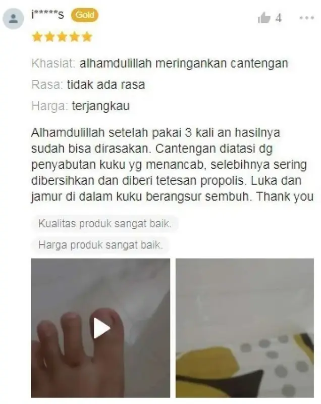Propolis Sm Untuk Kuku rusak, Hitam, Rapuh, Menebal, Berjamur, Menguning 2