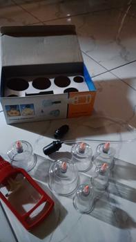 Product Review of Set Alat Bekam Isi 6 Tabung Kop Angin Alat Terapi Tradisional from N**g D**h 1