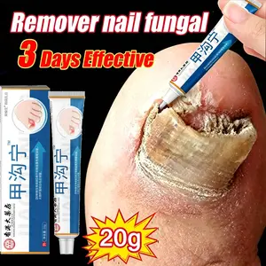 Obat Jamur Kuku Obat kuku jamur dan rusak Perawatan Kuku Berjamur Antibakteri Perawatan Kuku Onikomikosis Paronychia Anti Infeksi Kuku Toe Nail Pengobatan Jamur Minyak Nail Repair Essence Krim