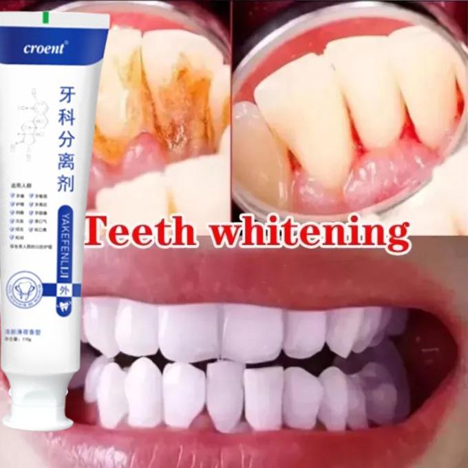 110gr Pasta Gigi Untuk Gigi Yang Goyang Pasta Gigi Biofarmasi Yang Memperbaiki Masalah Gigi Dan Memperbaiki Gigi Berlubang, Memperbaiki Gusi Rusak Dengan Cepat, Dan Memperbaiki Gigi 110gr 110gr Pasta Gigi Untuk Gigi Yang Goyang Pasta Gigi Biofarmasi Yang Memperbaiki Masalah Gigi Dan Memperbaiki Gigi Berlubang, Memperbaiki Gusi Rusak Dengan Cepat, Dan Memperbaiki Gigi 110gr