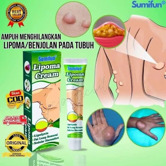 Product Introduction of sumifun lipoma solusi ampun menghilangkan benjolan 3