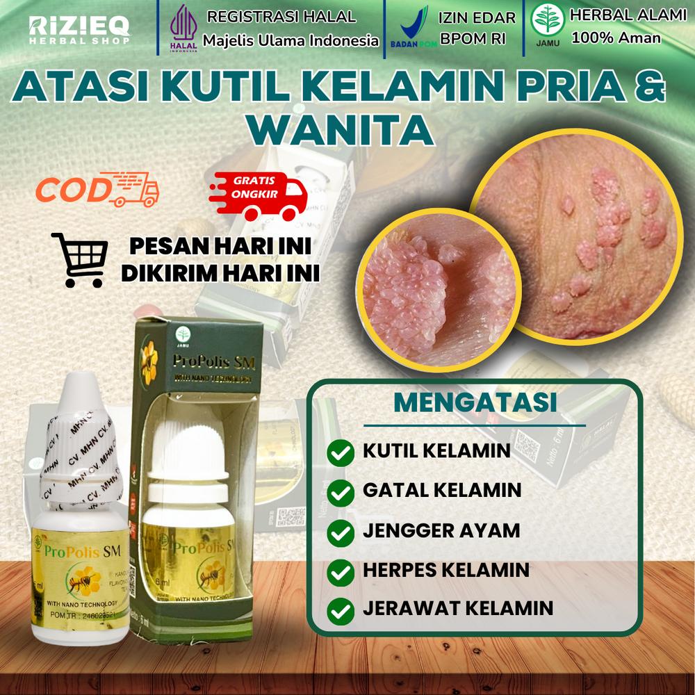 Cairan Tetes Penghilang Kutil Kelamin, Kutil Seperti Brokoli, Benjolan Jerawat di Miss V, Menghilangkan Bau dan Rasa Gatal, Infeksi Jamur, Penghilang Kutil HPV Untuk Wanita dan Pria dengan Propolis SM
