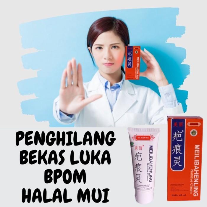 POPULER Promo penghilang bekas luka hitam koreng di kaki lama salep 3