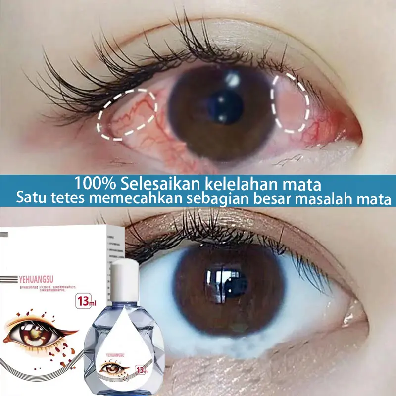 Tetes Mata Katarak eye drop 13ml 0