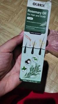 Product Review of Rosemary hair oil hair tonic penumbuh rambut dengan cepat dan botak tebal serum rambut rontok Hair growth serum Minyak from 얀** ** 0