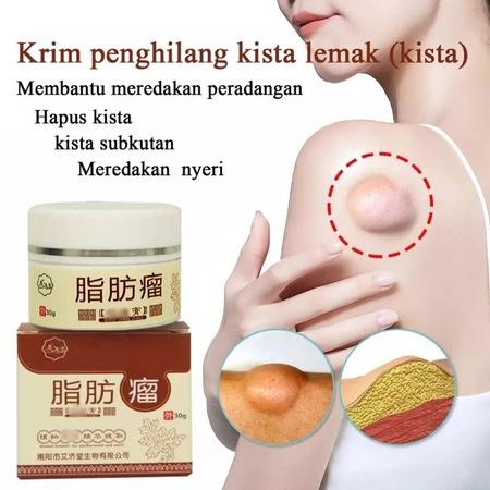 Lipoma Removal Cream Penghilang Kista & Lipoma Atasi Benjolan Lipoma Cepat Kempes Hilangkan Kista Lemak Kempes Tanpa Bedah