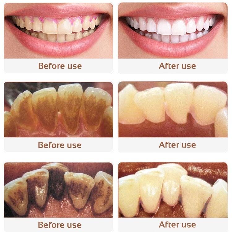 Pasta Gigi Pemutih SP-7 Probiotik 120g Menghilangkan Noda Karang Gigi Segar Aman untuk Siswa Dewasa dan Anak-anak Mencerahkan Gigi dan Membantu Memperbaiki Bau Mulut