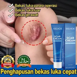 Obat penghilang bekas luka Salep penghilang bekas luka Penghilang bekas luka hitam 20g Menghilangkan bekas luka koreng Penghilang bekas gigitan nyamuk bekas luka di kaki keloid bekas luka bakas dan stretch mark Bekas Luka Luka Jahitan Bekas