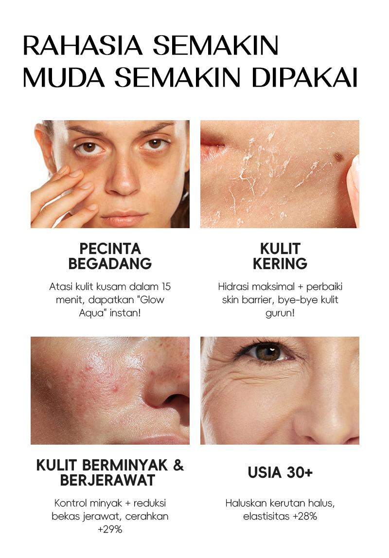 [Buy 2 Save 10% Off] ZOICY Masker Wajah Mencerahkan 2Box 10pcs - Whitening Sheet Mask | Melembapkan | Mengencangkan | Menutrisi | Menenangkan | Anti Kerut | Glowing | Niacinamide | Hyaluronic Acid | Salicylic Acid | Witch Hazel | Extract Centella Purslane