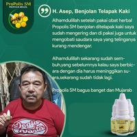 Gambar ProPolis SM Obat Kista Ganglion Benjolan Di Tangan dari Diherbalin Shop Kota Administrasi Jakarta Barat 5 Tokopedia
