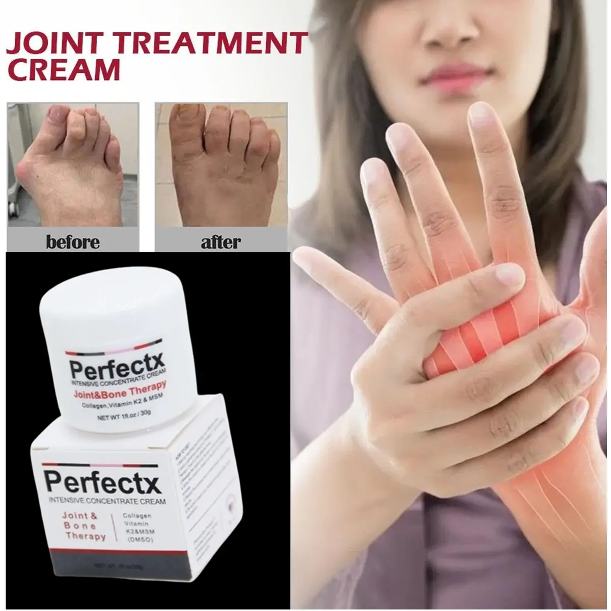 BISA COD PERFECTX Joint Bone Therapy Perfectx Intensive Concentrate Cream Krim THERAPHY Asam Urat Perfectx Cream Terapi Sendi Dan Tulang 30g Kaki Perawatan