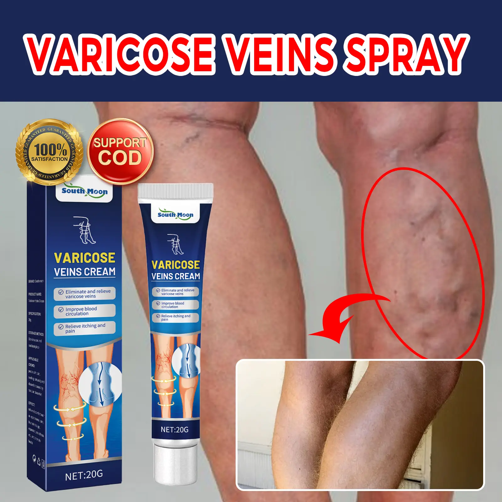 South Moon Varicose Veins Cream Obat Varises Salep Penghilang Varises Vaskulitis 20g