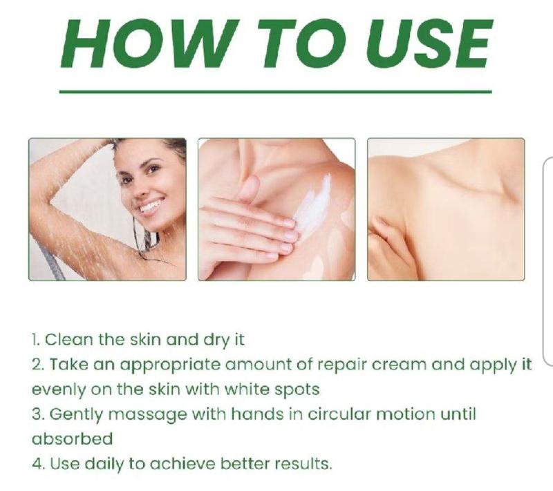 Product Introduction of krim penghilang vitiligo menghilanglan jamur panu dan mengatur pigmentasi kulit / vitiligo repair cream 22