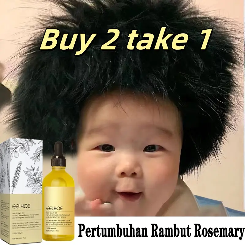 Rosemary Essential Oil Menumbuhkan Rambut Dengan Cepat Rambut Penumbuh Rambut Botak Penumbuh Rambut Botak Perawatan Rambut Rontok Obat Penumbuh Rambut Minyak Penumbuh Rambut Tersedia Untuk Pria Dan Wanita