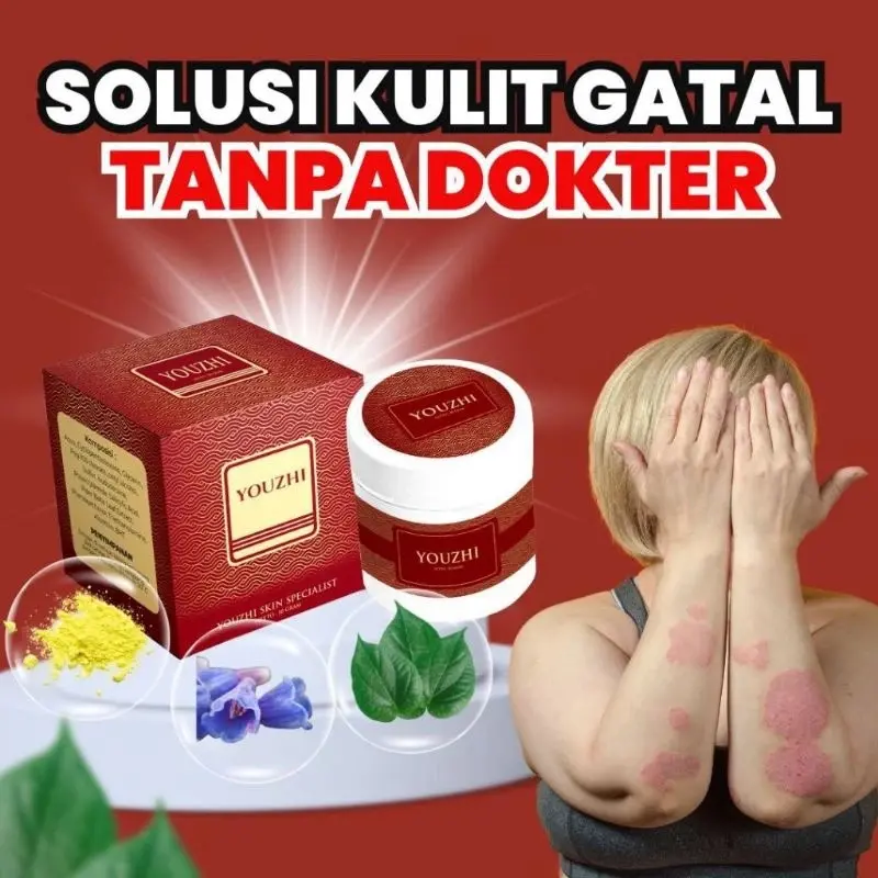 YOUZHI SALEP ATASI GATAL DAN RUAM PADA KULIT