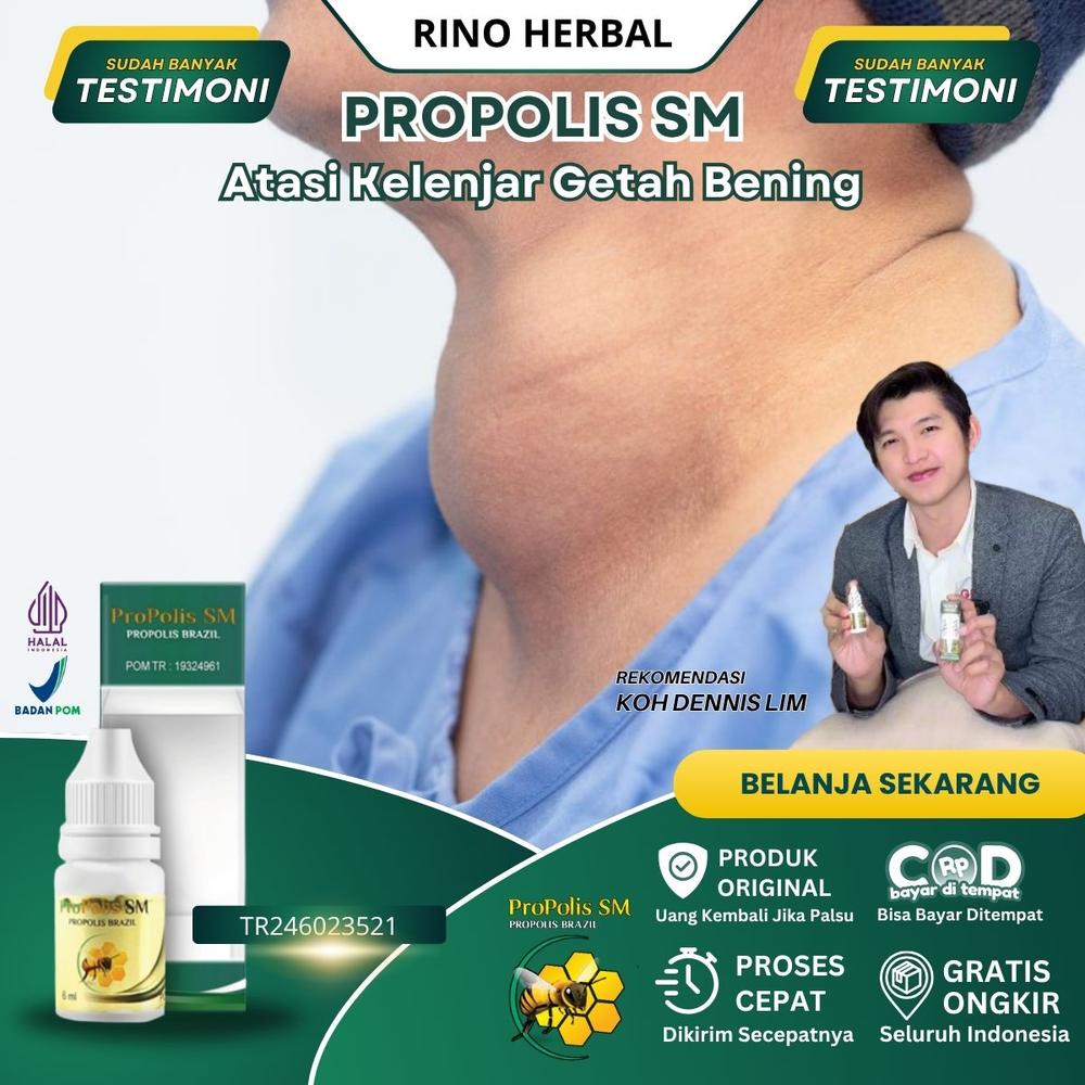 Obat Kelenjar Getah Bening, Benjolan Di Leher, Benjolan Lipoma, Kelenjar Tiroid, PALING AMPUH Namun Tergantung Kondisi Tubuh