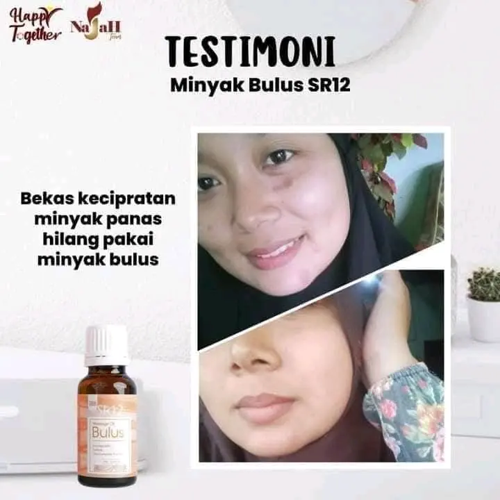 MINYAK BULUS SR12 / HERBAL ORY BPOM / PENGHILANG SEGALA MACAM BEKAS 1