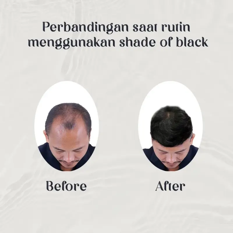 Hair Serum Shade Of Black | Menyehatkan kulit kepala dan merangsang pertumbuhan rambut 3